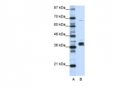 ARP40585_T100 - hnRPD-like protein / HNRPDL