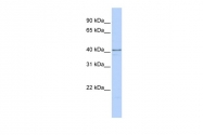 ARP40586_P050 - hnRPD-like protein / HNRPDL