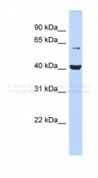 ARP40588_P050 - PIGK