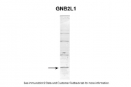 ARP40625_P050 - GNB2L1 / HLC7