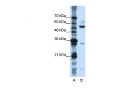 ARP40663_P050 - KHDRBS3