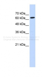 ARP40690_P050 - Ligatin