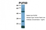 ARP40760_P050 - PUF60 / SIAHBP1