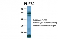 ARP40760_P050 - PUF60 / SIAHBP1