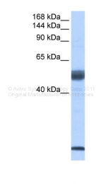 ARP40829_P050 - SF3B14 / SAP14