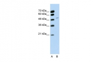 ARP40889_P050 - RBM22