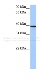 ARP41014_P050 - MRM1