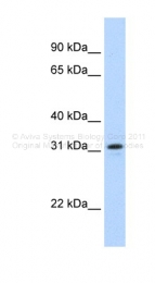 ARP41054_P050 - NIFK
