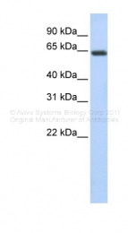 ARP41088_P050 - UPF3B / RENT3B