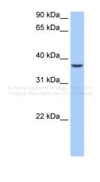 ARP41106_P050 - ALKBH8
