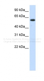 ARP41146_T100 - DIS3-like exonuclease 2