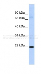 ARP41200_P050 - RBPMS2