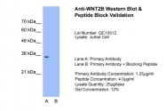 ARP41254_T100 - WNT2B