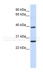 ARP41267_P050 - WNT16