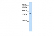 ARP41276_P050 - WNT2B