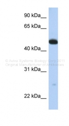 ARP41301_P050 - WDR1 / NORI-1