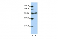 ARP41311_T100 - WDR13