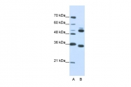 ARP41313_P050 - WDR6