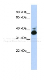 ARP41365_P050 - Aldolase B / ALDOB