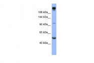 ARP41374_P050 - CD220 / INSR