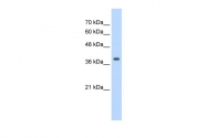 ARP41392_T100 - Tropomyosin-1 (TPM1)
