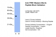 ARP41392_T100 - Tropomyosin-1 (TPM1)