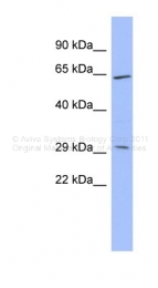 ARP41396_P050 - Histidine-rich glycoprotein / HRG
