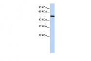 ARP41397_P050 - Histidine-rich glycoprotein / HRG