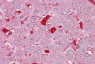 ARP41402_P050 - SERPINC1 / Antithrombin-III