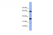 ARP41402_P050 - SERPINC1 / Antithrombin-III