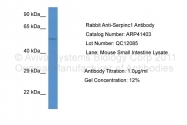 ARP41403_P050 - SERPINC1 / Antithrombin-III