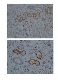 ARP41404_P050 - CYP1A1