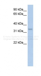 ARP41421_T100 - Carbonic anhydrase 4