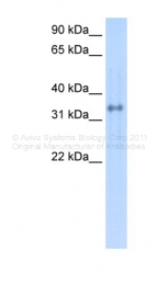ARP41422_P050 - Carbonic anhydrase 4
