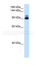 ARP41463_T100 - Alpha-actinin-2 / ACTN2