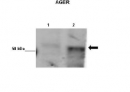 ARP41464_P050 - RAGE / AGER
