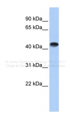 ARP41477_P050 - CKMM