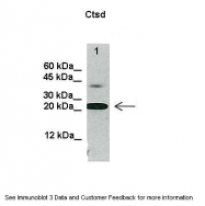 ARP41481_P050 - Cathepsin D
