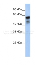 ARP41483_P050 - Desmin