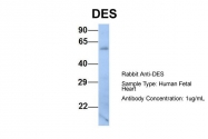 ARP41483_P050 - Desmin