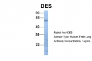 ARP41483_P050 - Desmin