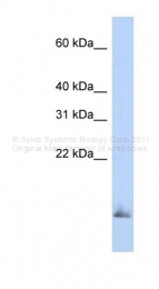 ARP41524_P050 - SCGB1A1 / Uteroglobin