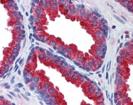 ARP41554_P050 - Klotho
