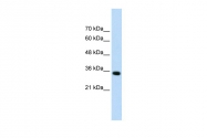 ARP41556_P050 - ADAMTS4
