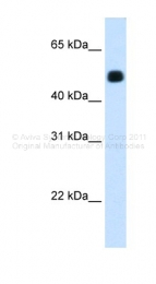 ARP41563_T100 - mHMG-CoA synthase / HMGCS2