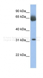 ARP41593_P050 - C11orf54
