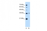 ARP41594_P050 - C11orf54