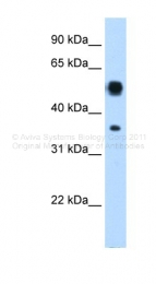 ARP41666_P050 - Arginosuccinase