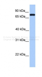 ARP41668_P050 - Complement C2
