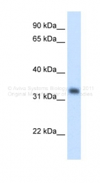 ARP41686_T100 - HMG-CoA lyase / HMGCL